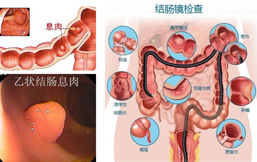 經(jīng)常放屁是在“排毒”？或許“根源”在腸道！